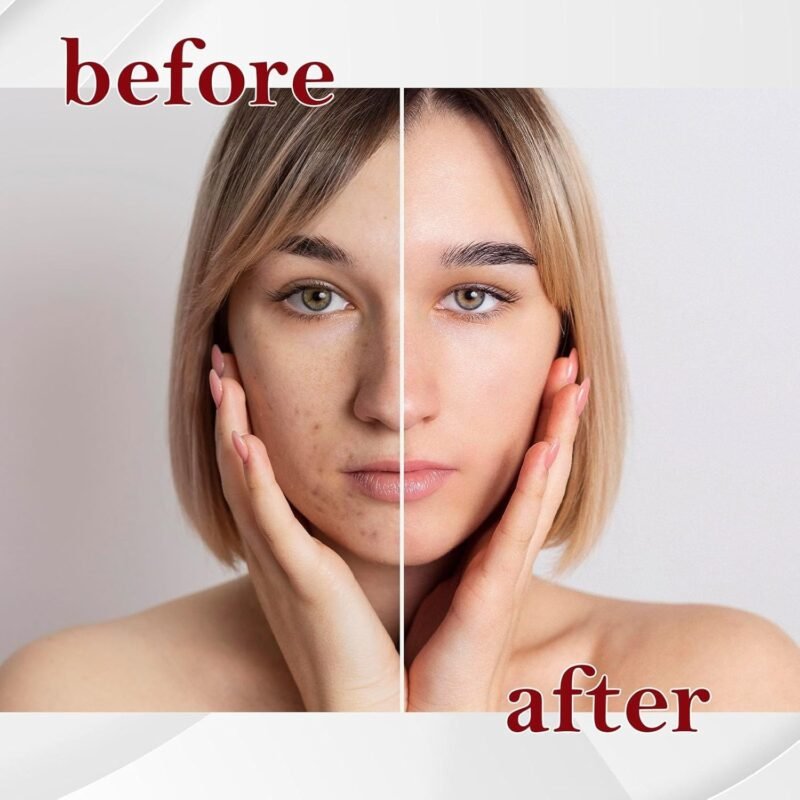 Moisturizing Primer Foundation With Hyaluronic Acid & Vitamin B5 For Sensitive Skin - Light Coverage Brightening Universal Shade - Image 6